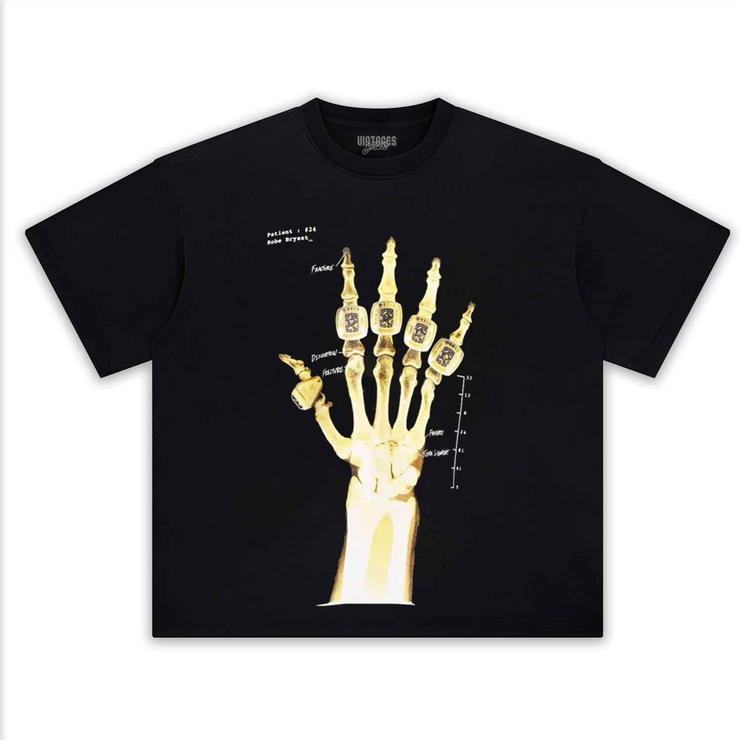 KOBE RÖNTGEN "BROKEN NOT BEEATEN" TEE